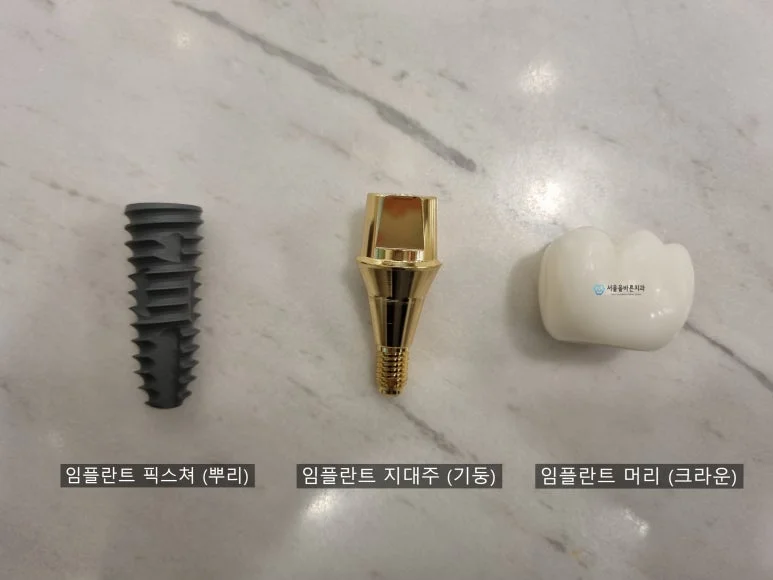 임플란트 구조, 왼쪽부터 픽스처, 지대주, 크라운